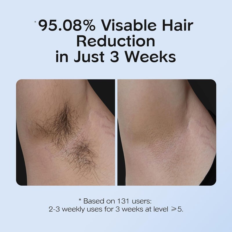 innza IPL Hair Removal with Ice Cooling Care Function for Women,Long-Lasting Results,999,999 Flashes Painless Hair Removal, Hair Removal Device for Armpits Legs Arms Bikini Line - Image 4